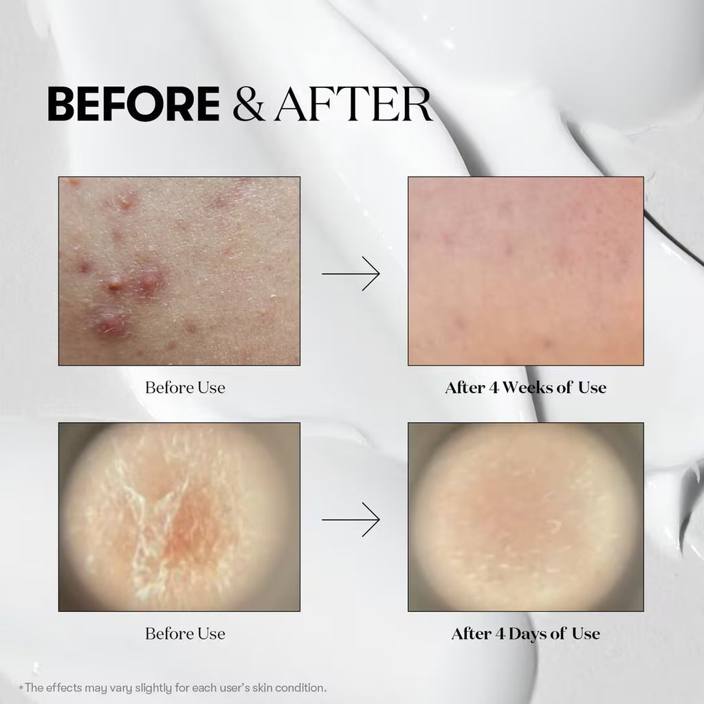 VT Cosmetics Reedle Shot 300 skin booster, 50ml - photo 4