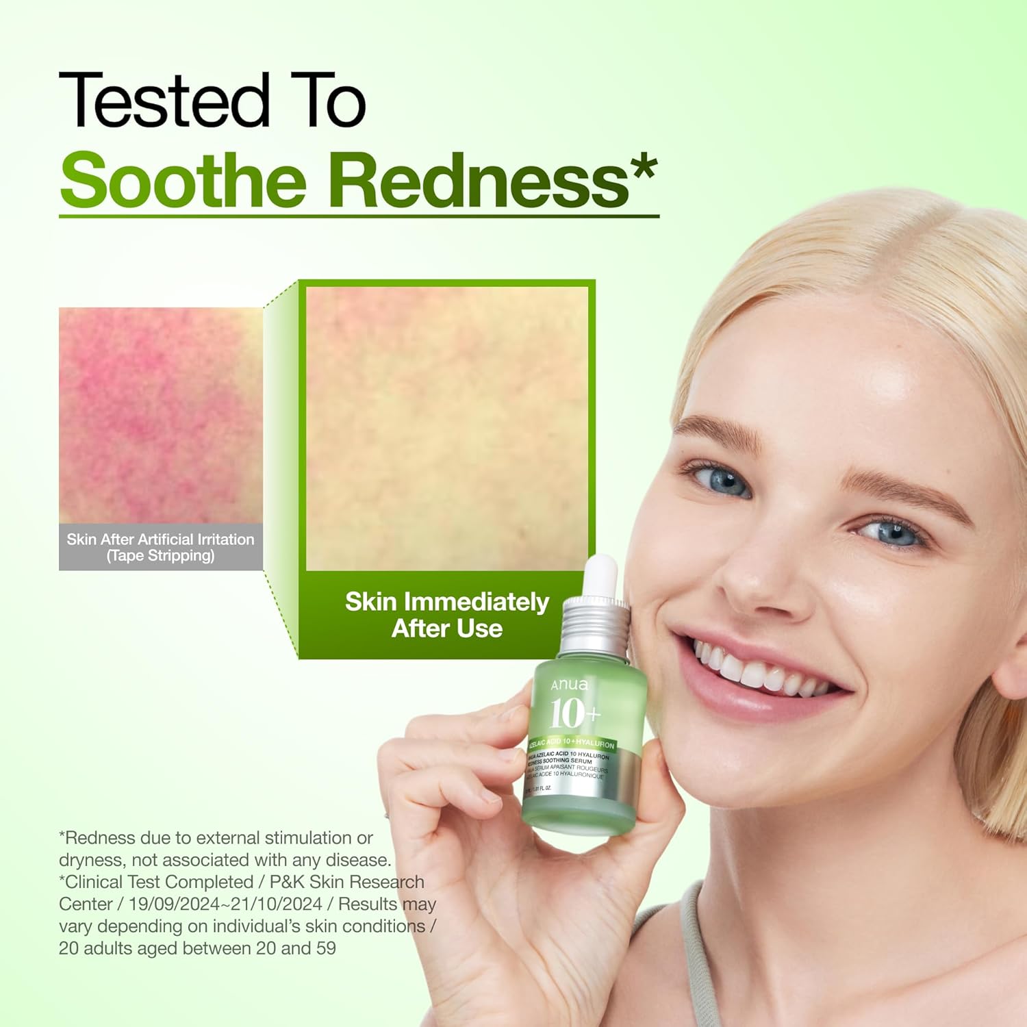 Anua Azelaic Acid 10 Redness Soothing Serum, 30ml - photo 5